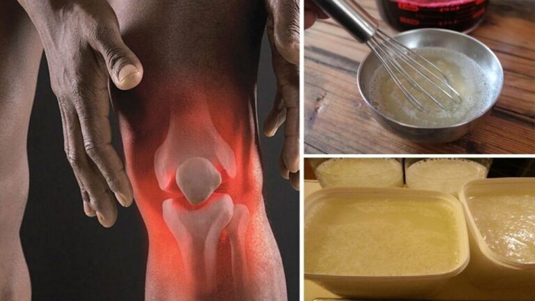 Drink Gelatin to Help Your Knee, Back, and Joint Pain Disappear